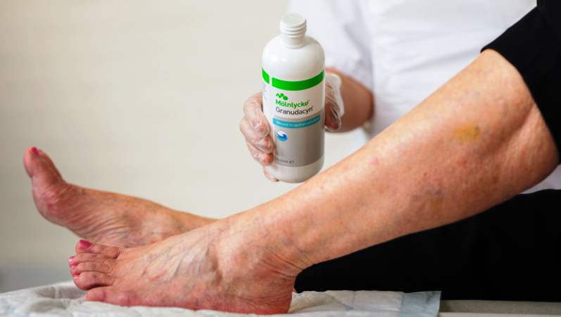 ferite post-operatorie