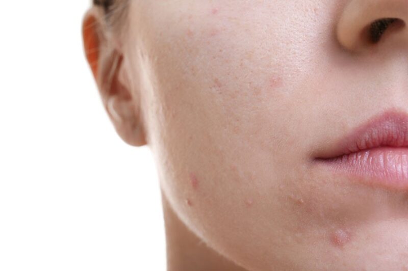 https://www.chirurgiadermatologicamilano.it/