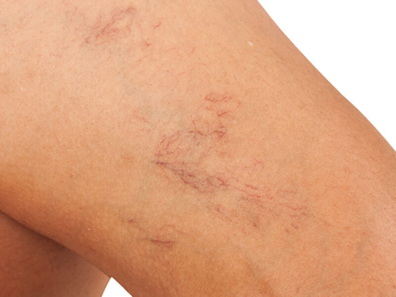 https://www.dermatologiamilano.it/