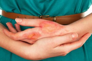 https://www.chirurgiadermatologica-milano.it/