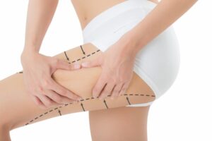 https://www.liposcultura.info/