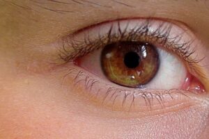 https://www.blefaroplasticagenova.it/