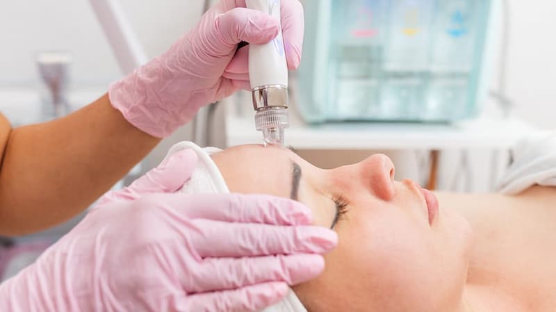 Minilifting non chirurgico del viso – full face