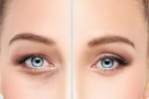 https://www.oculoplastica-giordanoresti.it/